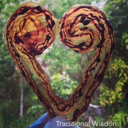 heart shaped umbilical cord